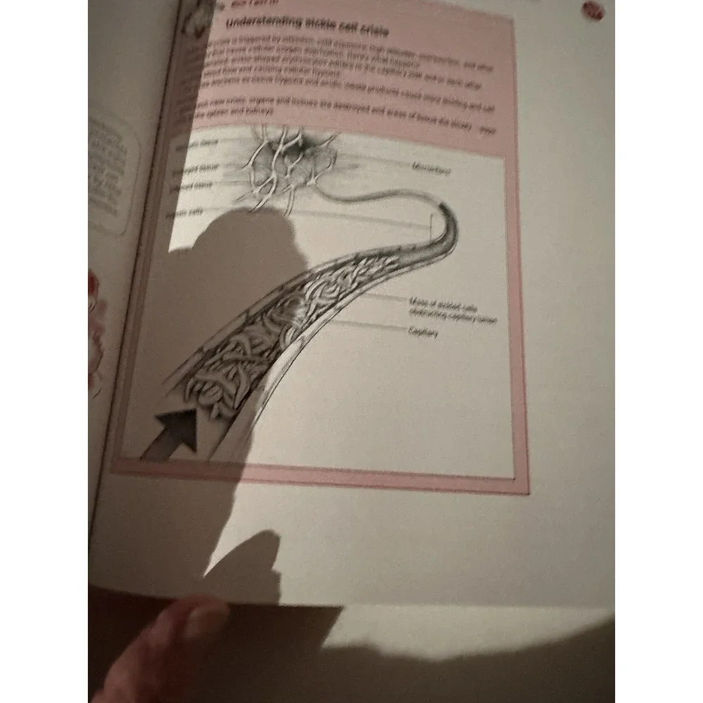 Studyguide for Pathophysiology Made Incredibly Easy by Lippincott 2d Edition EC